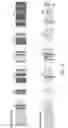 Fig. 13 - Anti-ROR1 antibodies
