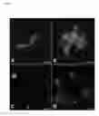 Fig. 13 - Molecularly imprinted polymers