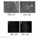 Fig. 08 - Pancreatic stromal progenitor cells
