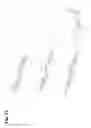Fig. 15 - COAGULATION FACTOR VII POLYPEPTIDES