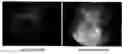 Fig. 01 - Methods and compositions for treating genetic eye diseases