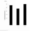 Fig. 06 - Immobilized poly(n)polymerase
