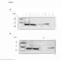 Fig. 07 - Immobilized poly(n)polymerase