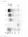 Fig. 11 - Immobilized poly(n)polymerase