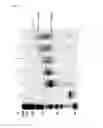 Fig. 12 - Immobilized poly(n)polymerase