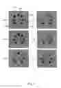 Fig. 12 - Automatic microfluidic system for antibiotic susceptibility testing and method of operating thereof