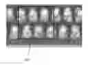 Fig. 01 - High aspect ratio electroplated structures and anisotropic electroplating processes