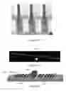 Fig. 13 - High aspect ratio electroplated structures and anisotropic electroplating processes