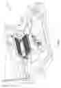 Fig. 02 - Stain removal tool for a laundry washing machine