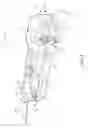 Fig. 06 - Stain removal tool for a laundry washing machine