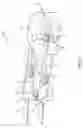 Fig. 07 - Stain removal tool for a laundry washing machine