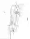 Fig. 06 - Stain removal tool for a laundry washing machine