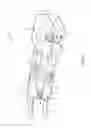 Fig. 07 - Stain removal tool for a laundry washing machine