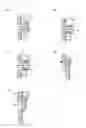 Fig. 08 - Construction method for reinforcing a column and reinforcing structure for a column