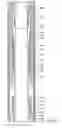 Fig. 05 - Hydrostatically actuable downhole piston