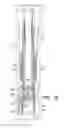 Fig. 08 - Dual barrier injection valve with a variable orifice