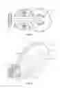 Fig. 03 - Device for delivering a medium