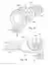 Fig. 16 - Cuff for air delivery conduit