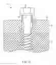 Fig. 11 - FASTENER WITH CLEANING AND LEVELING WINGS