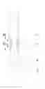 Fig. 01 - Variable Damping Shock Absorber and Washing Machine