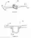 Fig. 03 - APPARATUS FOR DAMPENING A MAST ARM STRUCTURE HARMONICS