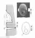 Fig. 03 - Tomography sample preparation systems and methods with improved speed, automation, and reliability