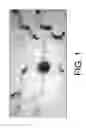 Fig. 02 - Device and methods of using device for detection of hyperammonemia
