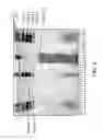 Fig. 08 - ULTRA-SMALL APOB-CONTAINING PARTICLES AND METHODS OF USE THEREOF