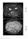 Fig. 22 - Systems and methods for automated detection in magnetic resonance images