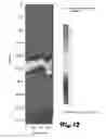 Fig. 13 - System and method for deep detection of petroleum and hydrocarbon deposits