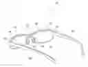 Fig. 01 - Nose pad and eyeglasses provided with the pad