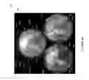 Fig. 08 - Spherical omnipolar imaging
