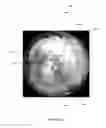 Fig. 10 - Spherical omnipolar imaging