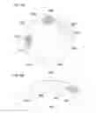 Fig. 08 - BIOMEDICAL SENSING METHODS AND APPARATUS FOR THE DETECTION AND PREVENTION OF LUNG CANCER STATES