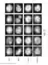Fig. 08 - Analyzing digital holographic microscopy data for hematology applications