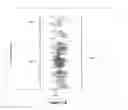 Fig. 19 - Detecting a transient error in a body fluid sample