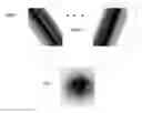 Fig. 01 - Geometry correction for computed tomography