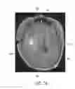 Fig. 16 - Systems and methods for automated detection in magnetic resonance images