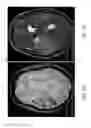 Fig. 22 - Systems and methods for automated detection in magnetic resonance images