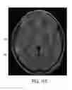 Fig. 23 - Systems and methods for automated detection in magnetic resonance images