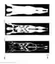 Fig. 06 - Whole body image registration method and method for analyzing images thereof