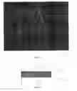 Fig. 05 - Registration of fluoroscopic images of the chest and corresponding 3D image data based on the ribs and spine