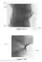Fig. 15 - Geometry correction for computed tomography