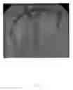 Fig. 05 - Extended high efficiency computed tomography with optimized recursions and applications
