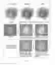 Fig. 08 - Extended high efficiency computed tomography with optimized recursions and applications