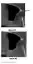 Fig. 06 - Systems and methods for an integrated system for visualizing, simulating, modifying and 3D printing 3D objects