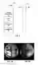 Fig. 04 - Oriented image stitching for spherical image content