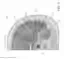 Fig. 06 - Surgical simulation systems, methods, and compositions