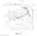 Fig. 14 - Surgical simulation systems, methods, and compositions