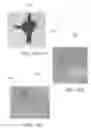 Fig. 22 - Surgical simulation systems, methods, and compositions